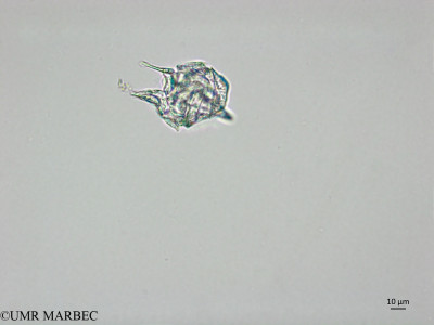 phyto/Brazilian_Nordeste/AtoldasRocas_station22/ABRACOS1 October 2015/Gonyaulax birostris (Snap-1994)(copy)_thumb.jpg